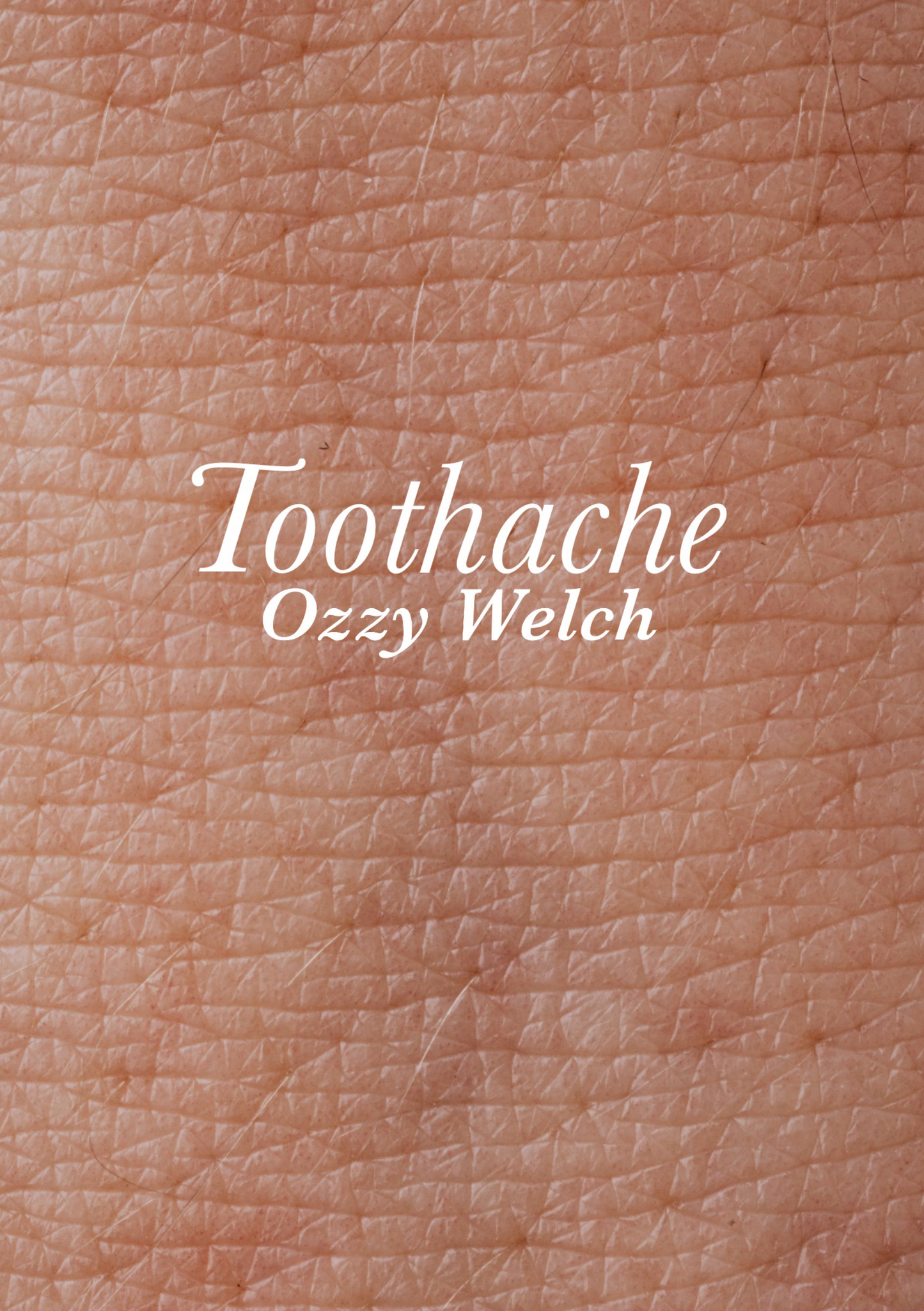 Toothache (Signed)